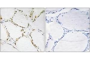 anti-FOXO1A/3A (AA 291-340) antibody