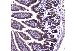Immunohistochemistry (IHC) image for anti-Succinate Dehydrogenase Complex, Subunit B, Iron Sulfur (Ip) (SDHB) (AA 29-280) antibody (ABIN5693211)