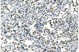 IHC analysis of B Raf/BRAF using anti-B Raf/BRAF antibody (ABIN3043761). (BRAF 抗体  (AA 38-230))