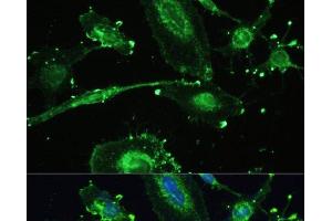 Immunofluorescence analysis of U-251MG cells using TREM2 Polyclonal Antibody at dilution of 1:100. (TREM2 抗体)