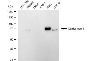 Western blotting analysis using caldesmon 1 antibody (ABIN7797840). (Recombinant Caldesmon 抗体)