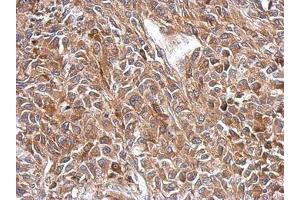 Image no. 1 for anti-3-Oxoacyl-ACP Synthase, Mitochondrial (OXSM) (AA 234-423) antibody (ABIN1501992) (OXSM 抗体  (AA 234-423))