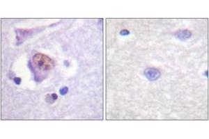 Immunohistochemistry analysis of paraffin-embedded human brain tissue, using SOX9 (Ab-181) Antibody. (SOX9 抗体  (AA 147-196))