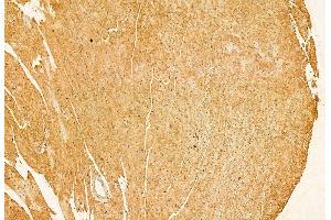 ABIN6264306 and ABIN6272878 at 1/100 staining Mouse heart tissue by IHC-P.