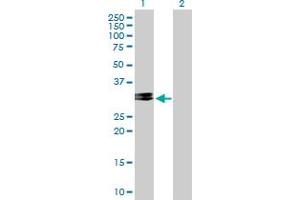 Western Blot analysis of CHMP2A expression in transfected 293T cell line by CHMP2A MaxPab polyclonal antibody.