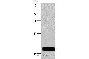 Western blot analysis of Mouse brain tissue, using DYNLL1 Polyclonal Antibody at dilution of 1:600 (DYNLL1 抗体)