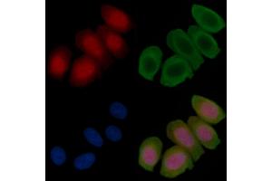Phospho-CRTC3 (Ser162) Antibody staining Hela cells(45 min of heat-shock treatment) by IF/ICC. (CRTC3 抗体  (pSer162))