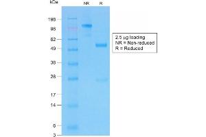 SDS-PAGE Analysis of Purifed CFTR Rabbit Recombinant Monoclonal Antibody (CFTR/1775R). (Recombinant CFTR 抗体  (AA 258-385))