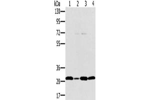Gel: 8 % SDS-PAGE, Lysate: 40 μg, Lane 1-4: Jurkat cells, hela cells, 293T cells, human thyroid cancer tissue, Primary antibody: ABIN7130584(PEF1 Antibody) at dilution 1/200, Secondary antibody: Goat anti rabbit IgG at 1/8000 dilution, Exposure time: 20 seconds (PEF1 抗体)
