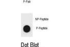 Dot blot analysis of KIT Antibody (Phospho ) Phospho-specific Pab (ABIN1881483 and ABIN2850467) on nitrocellulose membrane. (KIT 抗体  (pTyr553))