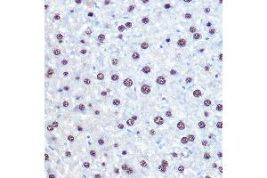 Immunohistochemistry of paraffin-embedded mouse liver using APIP Rabbit pAb (ABIN6131310, ABIN6136985, ABIN6136986 and ABIN6222909) at dilution of 1:100 (40x lens). (APIP 抗体  (AA 1-242))