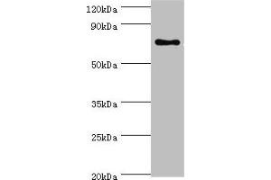 Western blot All lanes: SLC27A6 antibody at 4 μg/mL + MCF-7 whole cell lysate Secondary Goat polyclonal to rabbit IgG at 1/10000 dilution Predicted band size: 70 kDa Observed band size: 70 kDa (SLC27A6 抗体  (AA 370-619))