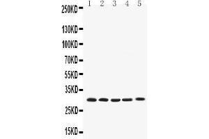 Western blot analysis of Bcl-XL using anti-Bcl-XL antibody . (BCL2L1 抗体  (AA 1-219))