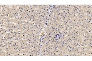 Detection of GPC3 in Human Liver Tissue using Monoclonal Antibody to Glypican 3 (GPC3) (Glypican 3 抗体  (AA 343-559))