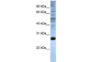 WB Suggested Anti-EIF4E Antibody Titration:  0. (EIF4E 抗体  (C-Term))