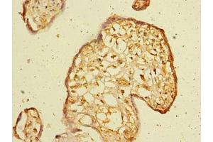 Immunohistochemistry of paraffin-embedded human placenta tissue using ABIN7175798 at dilution of 1:100 (WDR88 抗体  (AA 1-250))