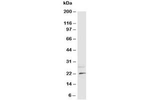 Western blot testing of NGF antibody and rat brain tissue lysate (Nerve Growth Factor 抗体  (N-Term))
