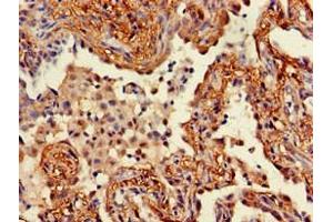 Immunohistochemistry (IHC) image for anti-Wingless-Type MMTV Integration Site Family, Member 5A (WNT5A) (AA 62-380) antibody (ABIN7166304)