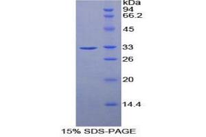 SDS-PAGE analysis of Mouse Ribonuclease Inhibitor Protein. (RNH1 蛋白)