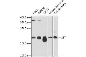 Western blot analysis of extracts of various cell lines using SST Polyclonal Antibody at dilution of 1:1000. (Somatostatin 抗体)