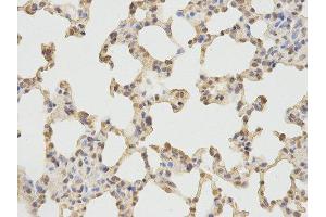Immunohistochemistry (IHC) image for anti-Protein Kinase, CGMP-Dependent, Type I (PRKG1) antibody (ABIN1874320) (PRKG1 抗体)