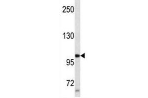 Progesterone Receptor antibody western blot analysis in SK-BR-3 lysate.