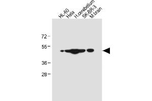 All lanes : Anti-CEPT1 Antibody (N-term) at 1:4000 dilution Lane 1: HL-60 whole cell lysate Lane 2: Hela whole cell lysate Lane 3: Human cerebellum tissue lysate Lane 4: SK-BR-3 whole cell lysate Lane 5: Mouse brain tissue lysate Lysates/proteins at 20 μg per lane. (CEPT1 抗体  (N-Term))