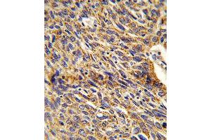 Immunohistochemistry (IHC) image for anti-Enoyl-CoA Delta Isomerase 1 (ECI1) antibody (ABIN3003901) (DCI 抗体)