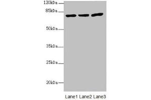 Western blot All lanes: KBTBD7 antibody at 1. (KBTBD7 抗体  (AA 475-684))
