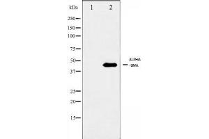 Western Blotting (WB) image for anti-Actin, alpha 2, Smooth Muscle, Aorta (ACTA2) (N-Term) antibody (ABIN6254917)