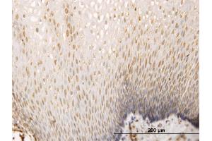 Immunoperoxidase of monoclonal antibody to SH3D19 on formalin-fixed paraffin-embedded human esophagus.