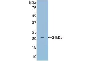 Detection of Recombinant Slit1, Mouse using Polyclonal Antibody to Slit Homolog 1 (Slit1) (SLIT1 抗体  (AA 603-773))