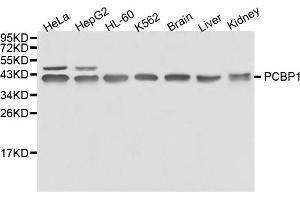 Western blot analysis of extracts of various cell lines, using PCBP1 antibody. (PCBP1 抗体)