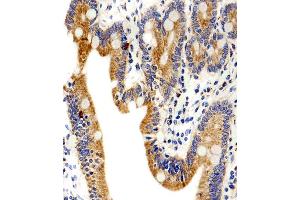 Immunohistochemical analysis of paraffin-embedded H. (ADRA1D 抗体  (N-Term))