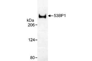 Western blot analysis of human TP53BP1 using TP53BP1 polyclonal antibody . (TP53BP1 抗体)