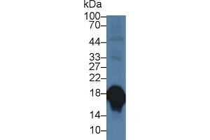 Detection of SOD1 in Porcine Cerebrum lysate using Polyclonal Antibody to Superoxide Dismutase 1 (SOD1) (SOD1 抗体  (AA 2-153))