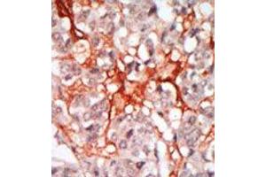 Image no. 1 for anti-Megakaryocyte-Associated tyrosine Kinase (MATK) (N-Term) antibody (ABIN359988) (MATK 抗体  (N-Term))