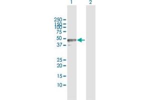 Western Blot analysis of TRIM62 expression in transfected 293T cell line by TRIM62 MaxPab polyclonal antibody. (TRIM62 抗体  (AA 1-475))