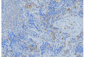 ABIN6276777 at 1/100 staining Human lymph node tissue by IHC-P. (GSTA1 抗体  (N-Term))