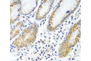 Immunohistochemistry of paraffin-embedded Human stomach using ATAD3A Polyclonal Antibody at dilution of 1:100 (40x lens). (ATAD3A 抗体)