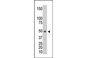 The anti-CKM Pab (ABIN391096 and ABIN2841235) is used in Western blot to detect CKM in C6 cell lysate. (CKM 抗体  (C-Term))