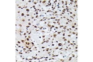 Immunohistochemistry (IHC) image for anti-Heterogeneous Nuclear Ribonucleoprotein M (HNRNPM) (AA 491-730) antibody (ABIN6141919)