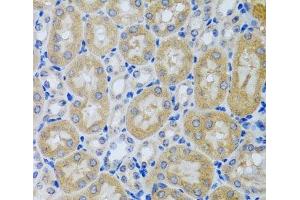 Immunohistochemistry of paraffin-embedded Mouse kidney using ACP1 Polyclonal Antibody at dilution of 1:100 (40x lens). (ACP1 抗体)