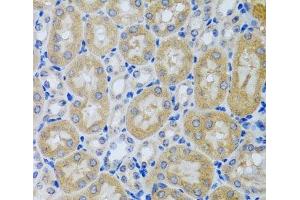 Immunohistochemistry of paraffin-embedded Mouse kidney using ACP1 Polyclonal Antibody at dilution of 1:100 (40x lens).