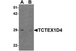 Western blot analysis of TCTEX1D4 in mouse liver tissue lysate with TCTEX1D4 antibody at 1 ug/mL in (A) the absence and (B) the presence of blocking peptide.