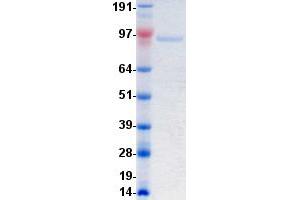 Western Blotting (WB) image for PTK7 Protein tyrosine Kinase 7 (PTK7) protein (DYKDDDDK-His Tag) (ABIN2730089)