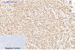 Immunohistochemical analysis of paraffin-embedded human breast cancer tissue. (POU2F1 抗体)