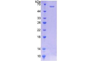 SDS-PAGE analysis of Rat NAT2 Protein. (NAT2 蛋白)