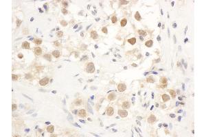 Immunohistochemistry (IHC) image for anti-Checkpoint Kinase 1 (CHEK1) (AA 250-300) antibody (ABIN7453553) (CHEK1 抗体  (AA 250-300))