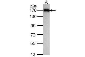 Western Blotting (WB) image for anti-Membrane Associated Guanylate Kinase, WW and PDZ Domain Containing 2 (MAGI2) (C-Term) antibody (ABIN2855926)